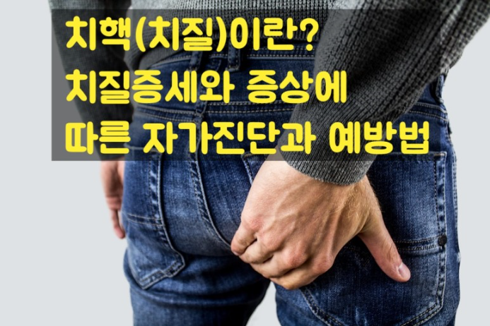 치질증세치질증상