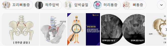 엉치뼈 천추골절 후유장해보험금