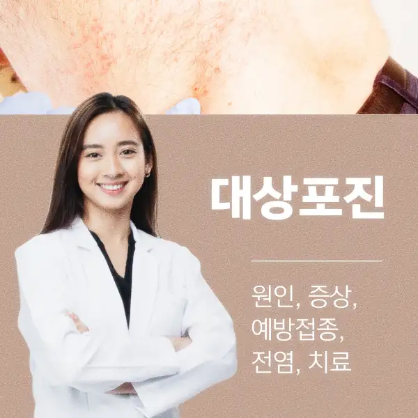 대상포진 원인&amp;#44; 증상&amp;#44; 예방접종&amp;#44; 전염&amp;#44; 치료