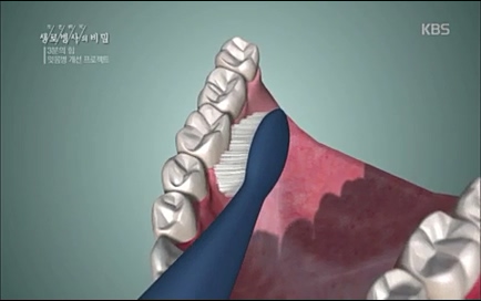 [670회] 생로병사의 비밀 - KBS670회] 생로병사의 비밀.ts_20220505_142255.181.jpg