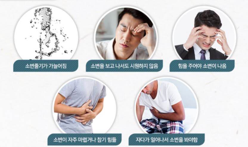 전립선비대증 증상 치료방법