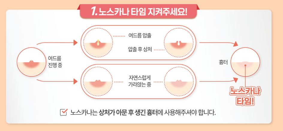 노스카나 사용법1