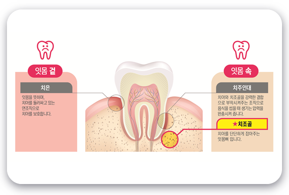 잇몸 속 사진