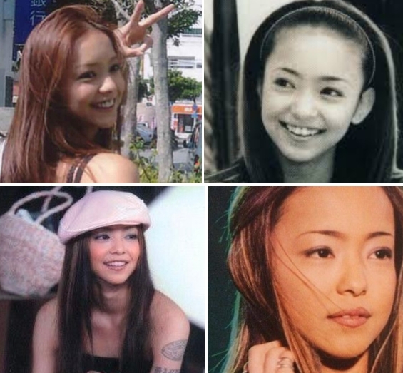 아무로나미에