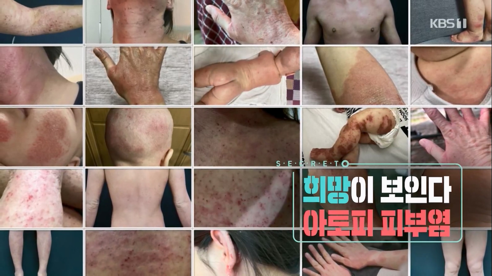 생로병사의 비밀.E872.230628p.H264-F1RST.mp4_20230707_212510.453.jpg