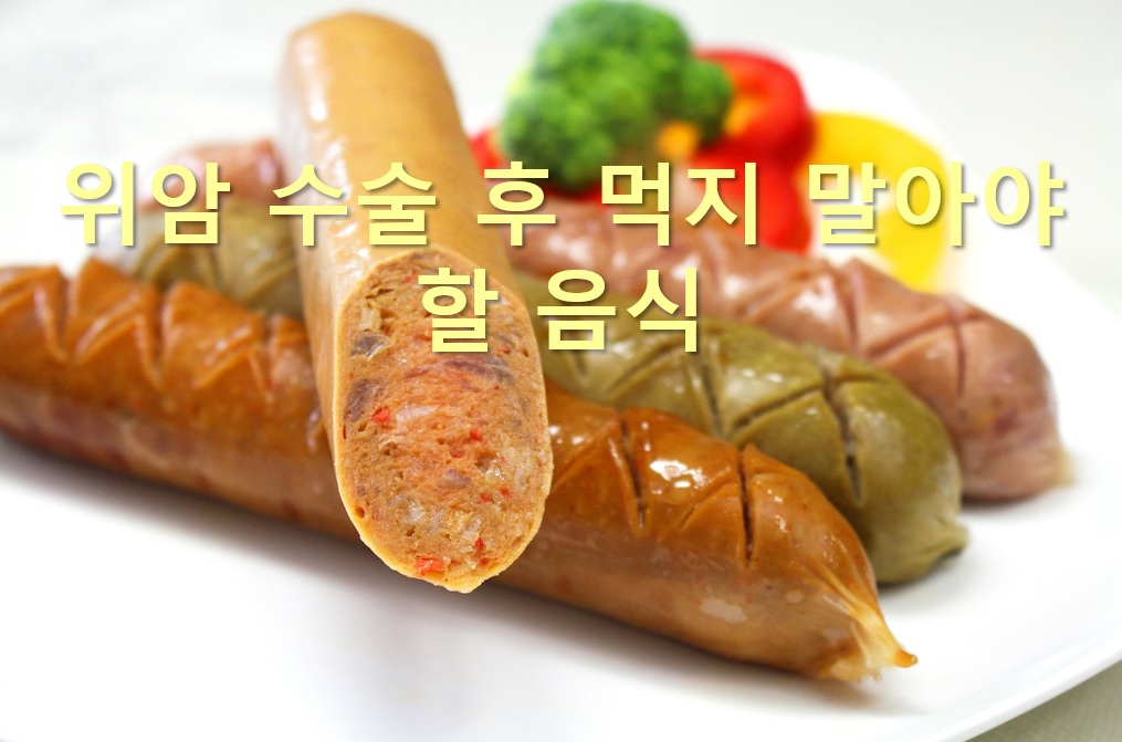  위암 수술 후 먹지 말아야 할 음식과 위암 수술 후 회복기간