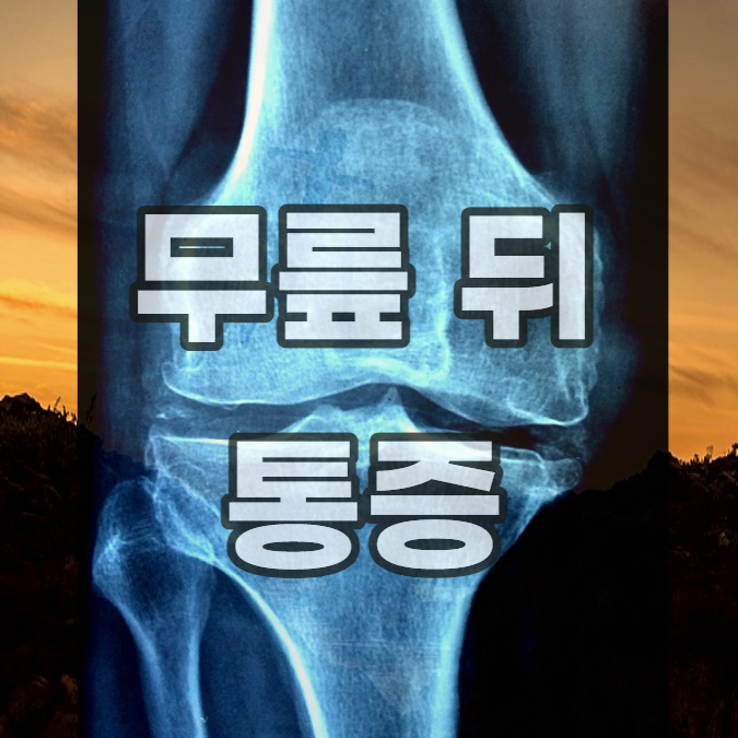 무릎-뒤-통증-뒤쪽-스트레칭-근육-힘줄-당김