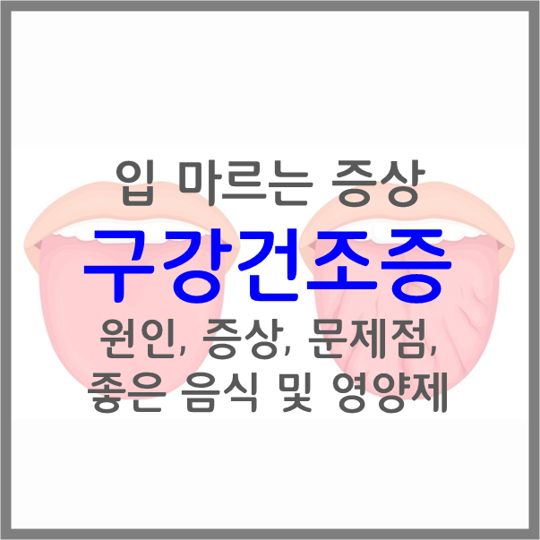  입 안이 마르는 구강건조증 원인, 증상, 문제점, 좋은 음식 및 영양제