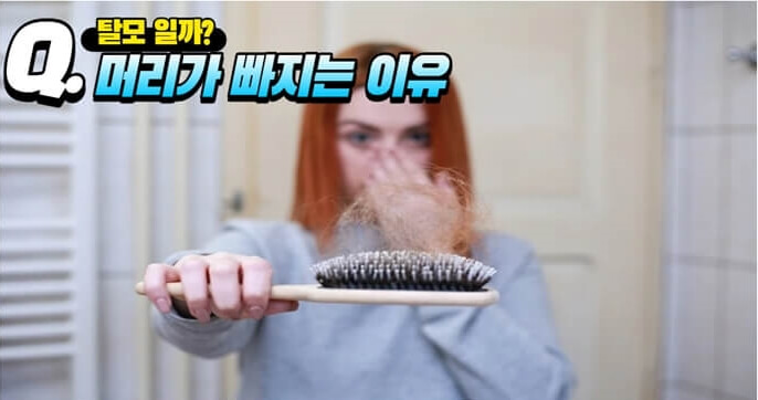  탈모 종류 및 자가 진단과 개선 방법