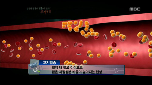  고지혈증 영양제 코엔자임큐텐 효능과 부작용