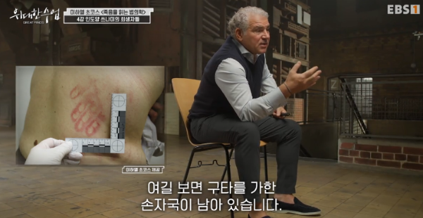 &quot;alt&quot;:&quot;손자국으로 나타난 가정 폭력 사례&quot;