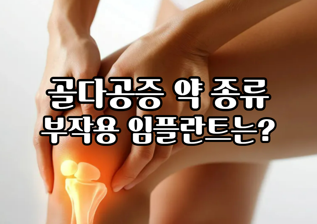 골다공증 약 종류 부작용, 임플란트 가능할까요
