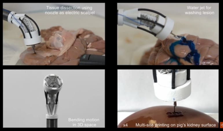 생체 재료로 조직 만드는 3D 프린팅 기술 VIDEO:The prototype could double as an all-in-one surgical tool