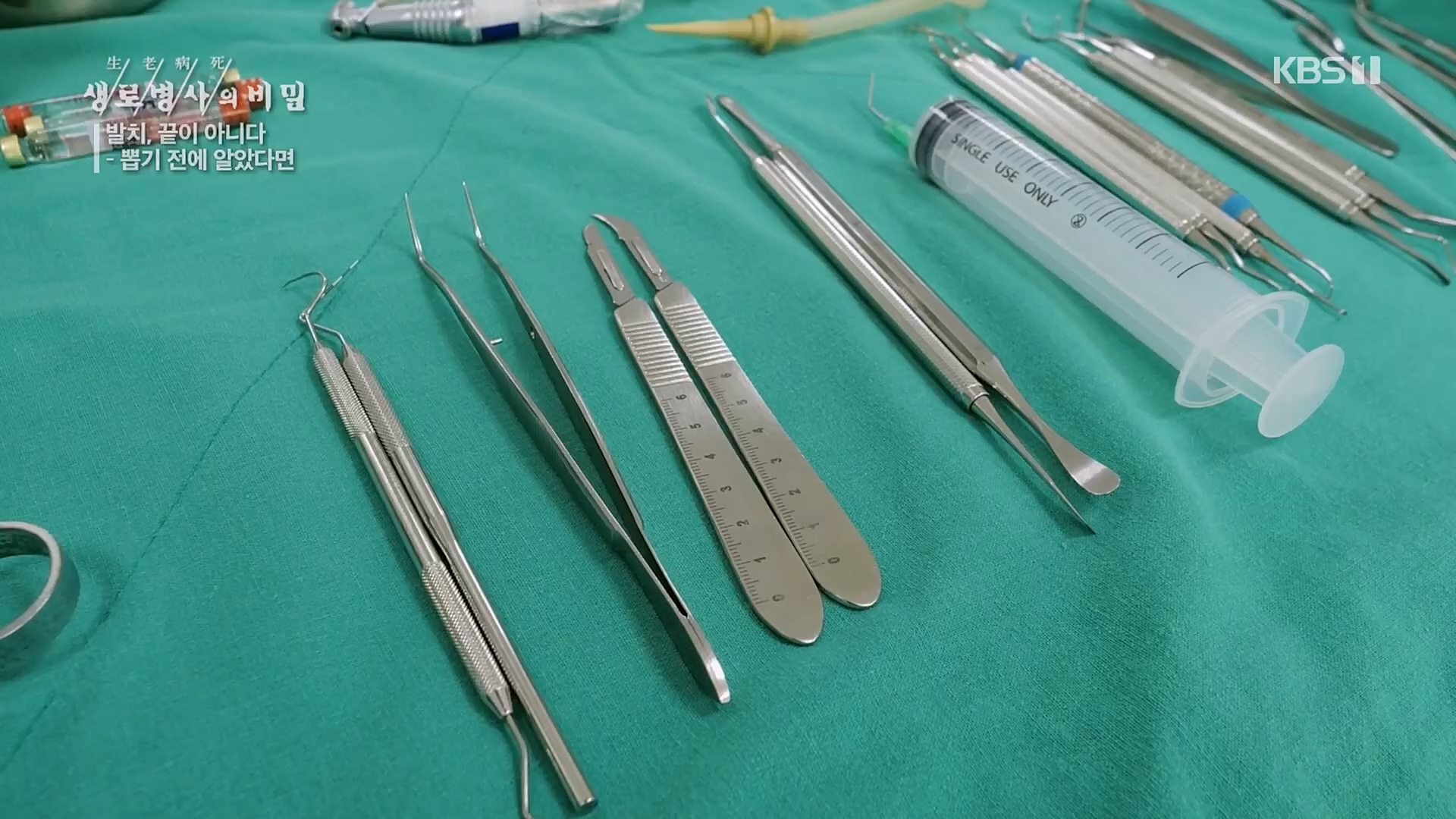 생로병사의 비밀.E855.230208p.H264-F1RST.mp4_20230214_194926.651.jpg