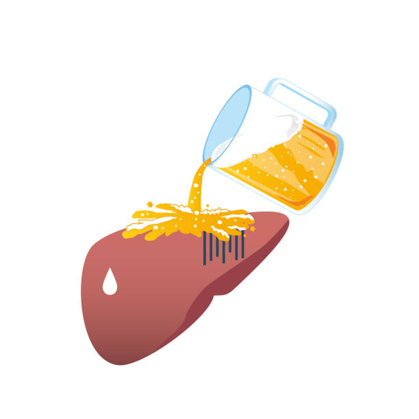 높은 중성 지방의 증상 요약 11