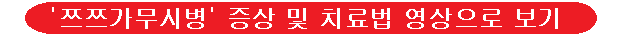 쯔쯔가무시-이미지