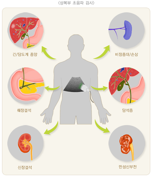 상복부