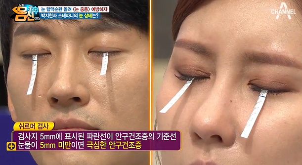 쇼그렌 증후군에 대하여 2