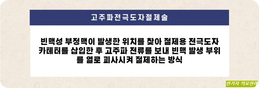 고주파전극도자절제술 방법