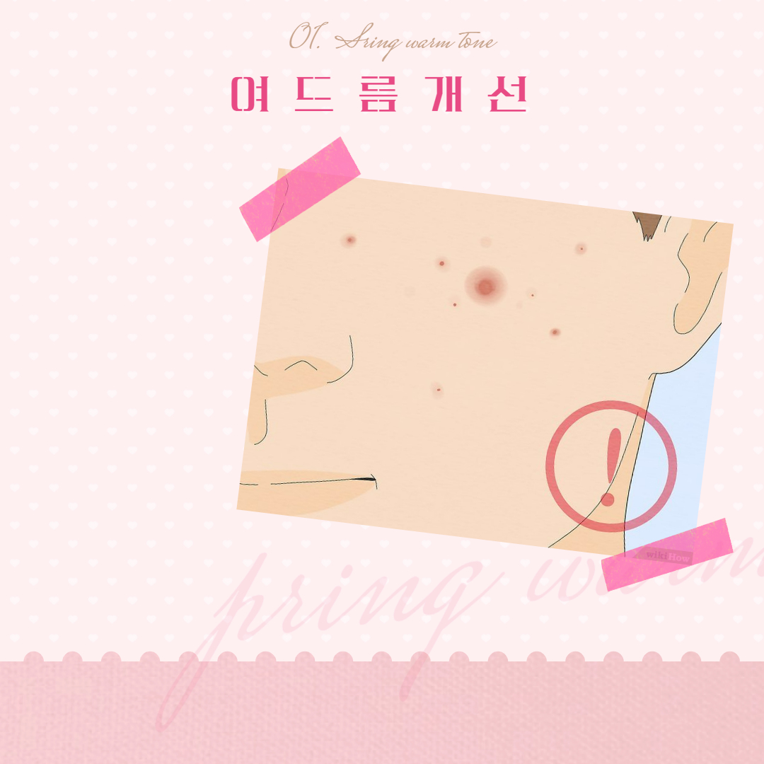 비오틴 여드름 개선 효능 설명 이미지