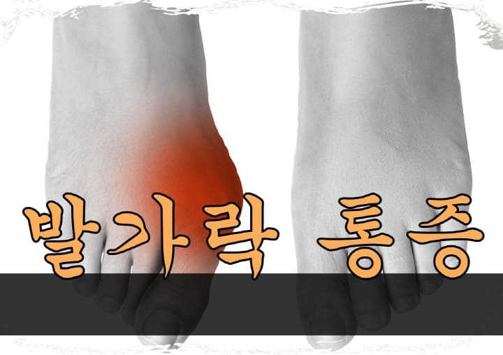 엄지 발가락 위쪽 통증아래 통증 발톱 통증 이유