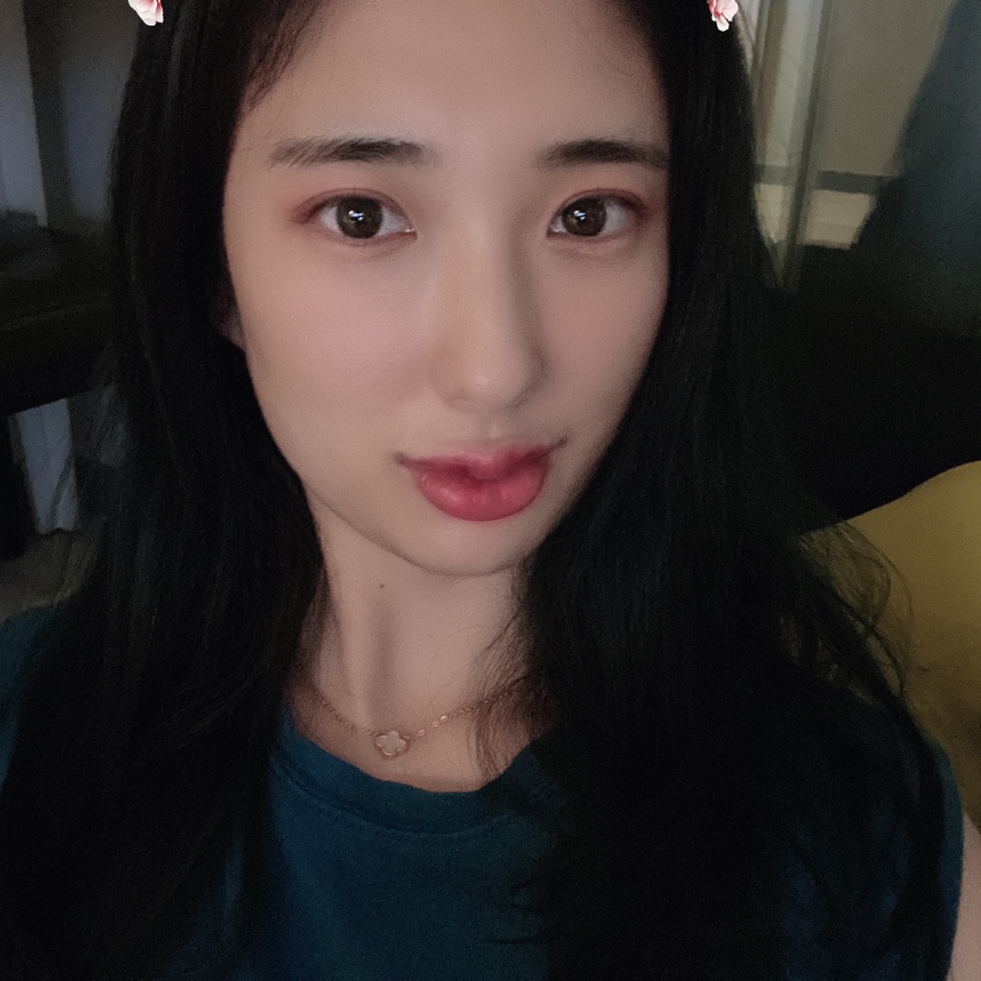 입술 보톡스 부작용 대전 입술필러+입꼬리보톡스 내돈내산 3