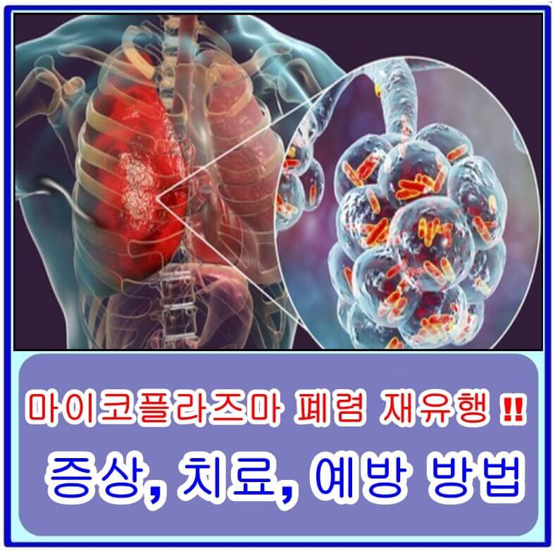  2023년 마이코플라즈마 폐렴 재유행 주의보!! 증상, 치료, 예방 방법은?