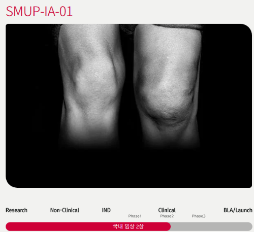 메디포스트-줄기세포-기반-치료제-SUMP-IA-01-무릎관절-모습
