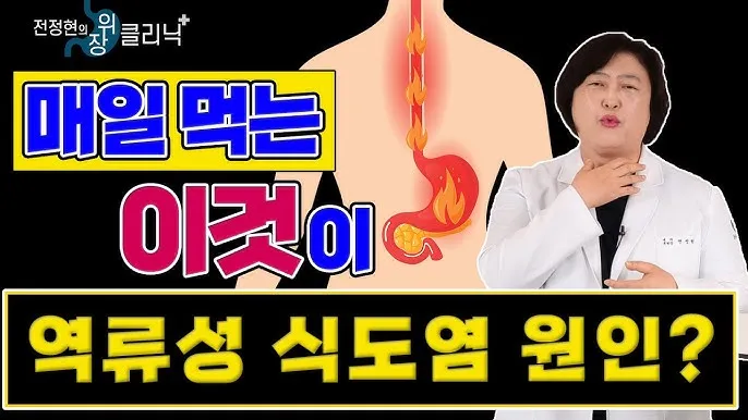 식도염에 좋은 음식 안좋은 음식_4