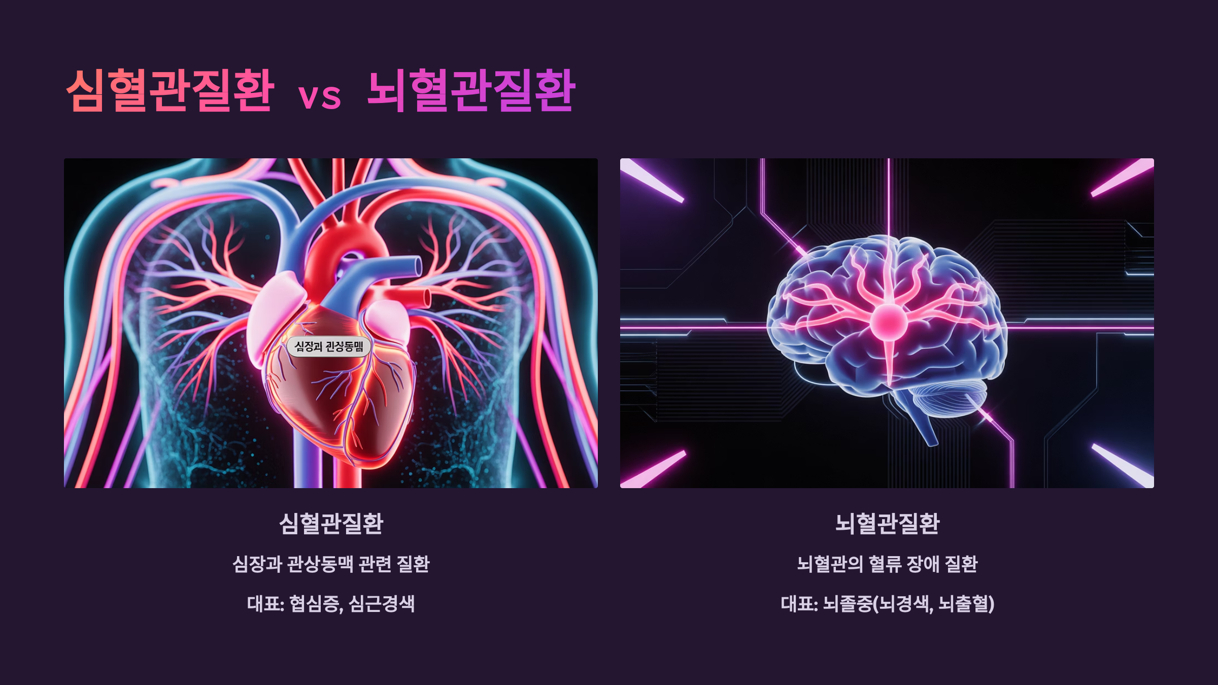 심혈관질환 vs 뇌혈관질환, 어떻게 다를까