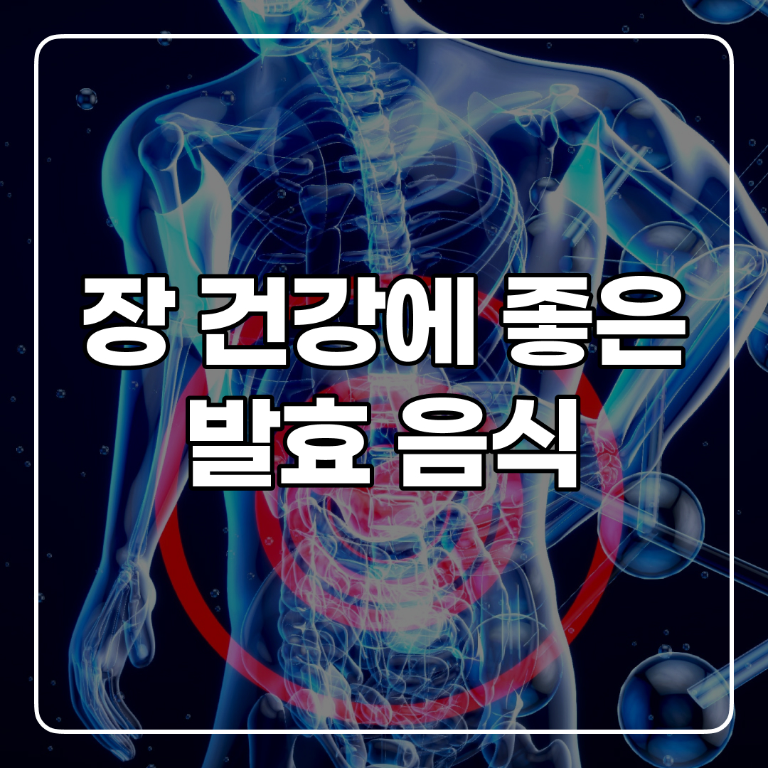  장이 안 좋으면 '발효 식품'부터 먹어보기!