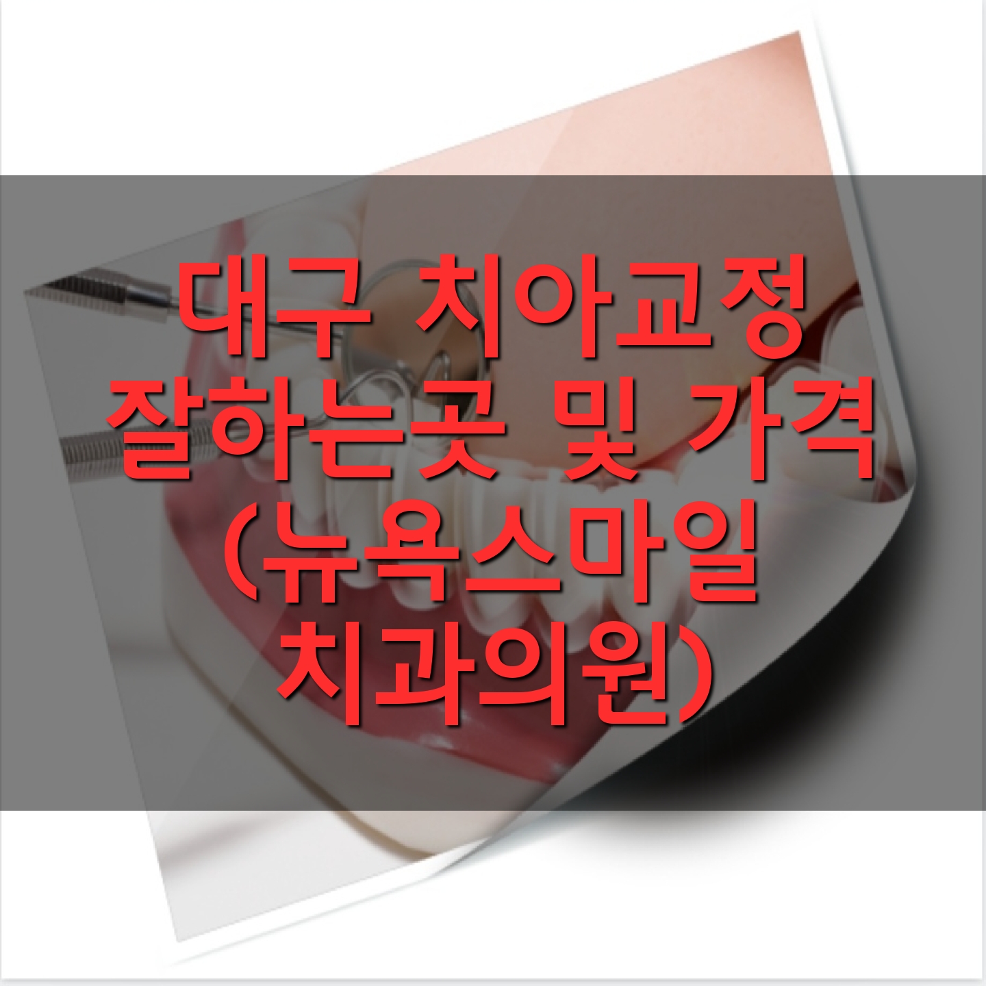 대구 치아교정 잘하는곳