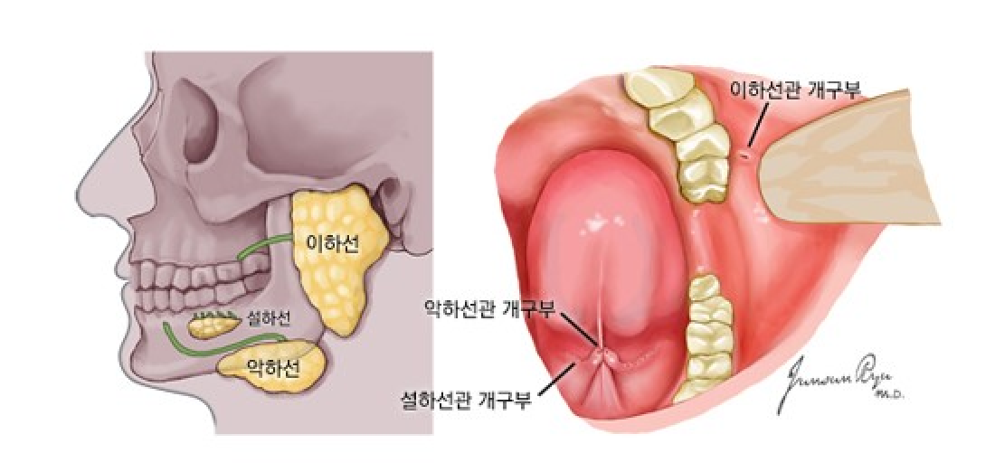 귀 밑 멍울? 늦게 발견하면 치명적인 침샘암