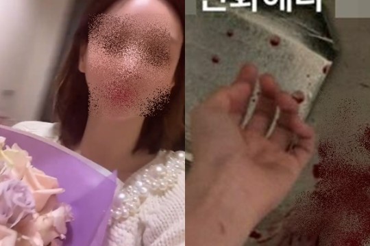 '남양 외손녀' 황하나, 4억 외제차 도난→피투성이 자해 "힘들고 지쳐"