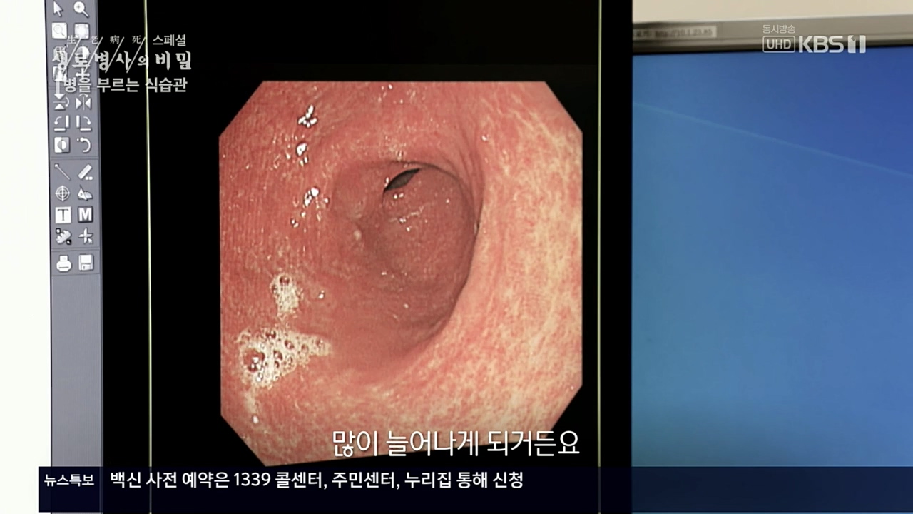 생로병사의 비밀.E844.221124p.H264-F1RST.mp4_20221124_201110.807.jpg