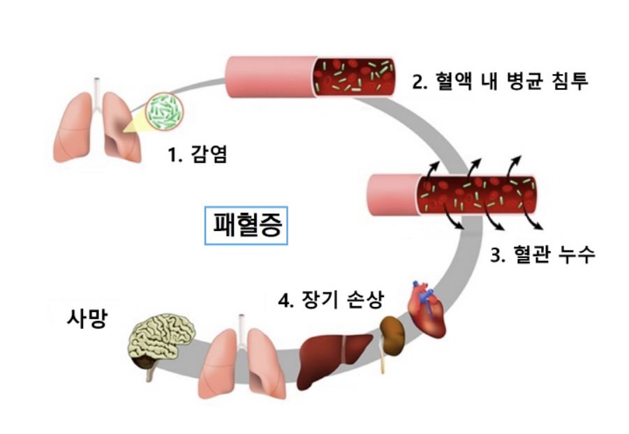 패혈증 이란?