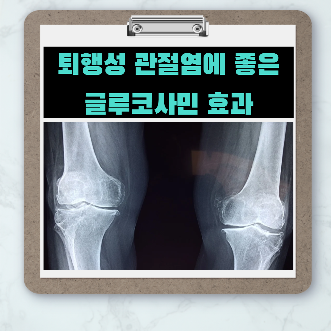  글루코사민 효능- 피부미용,무릎통증개선