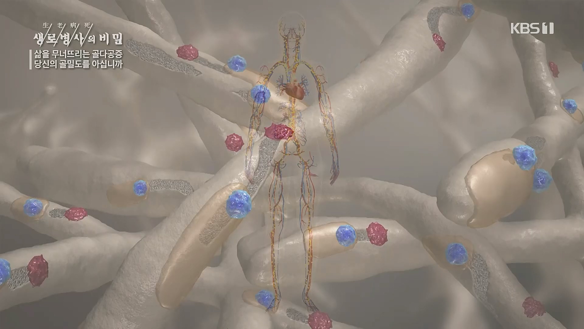 생로병사의 비밀.E852.230118p.H264-F1RST.mp4_20230120_200310.204.jpg