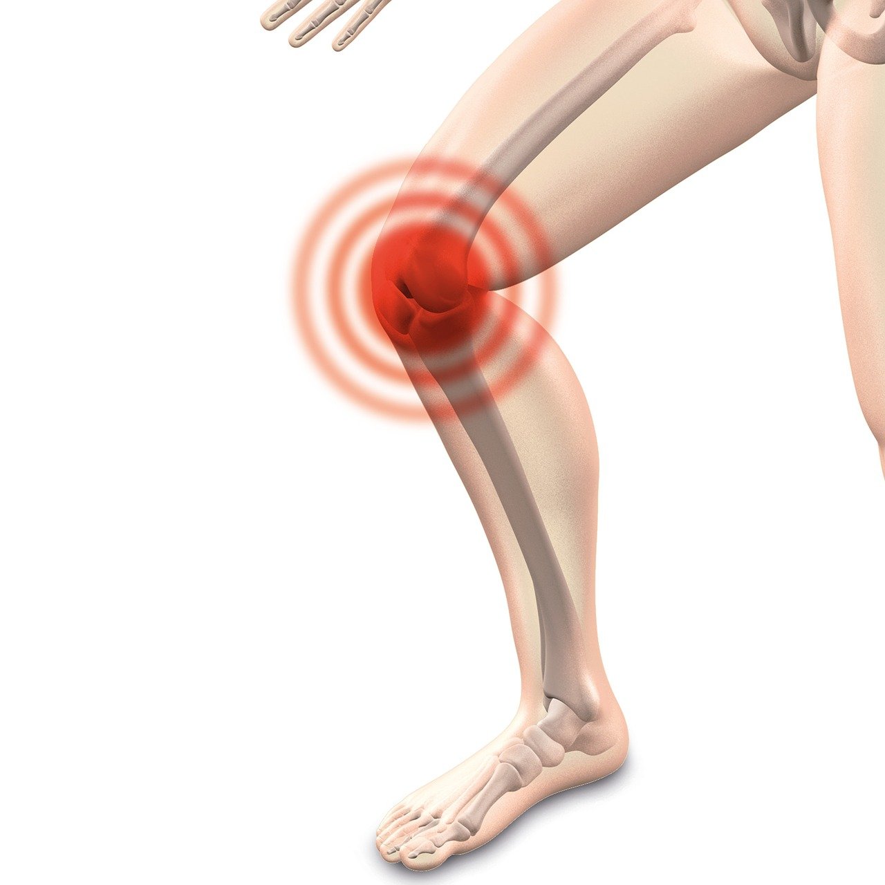 오른쪽 다리와 뼈 관절 무릎에 붉은 원
