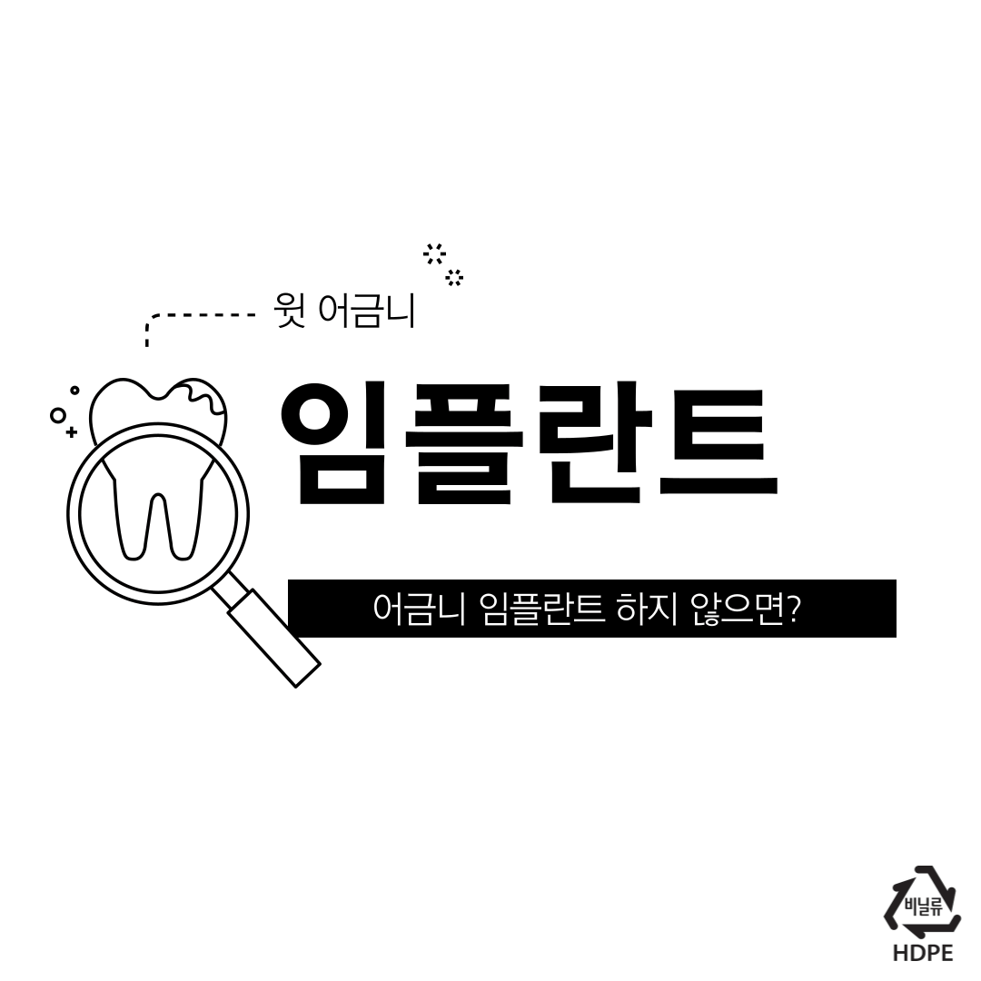 어금니임플란트가격 비교시 주의할 8