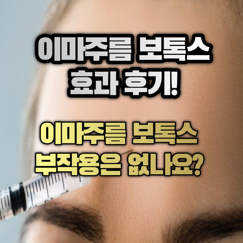 이마주름 보톡스 효과