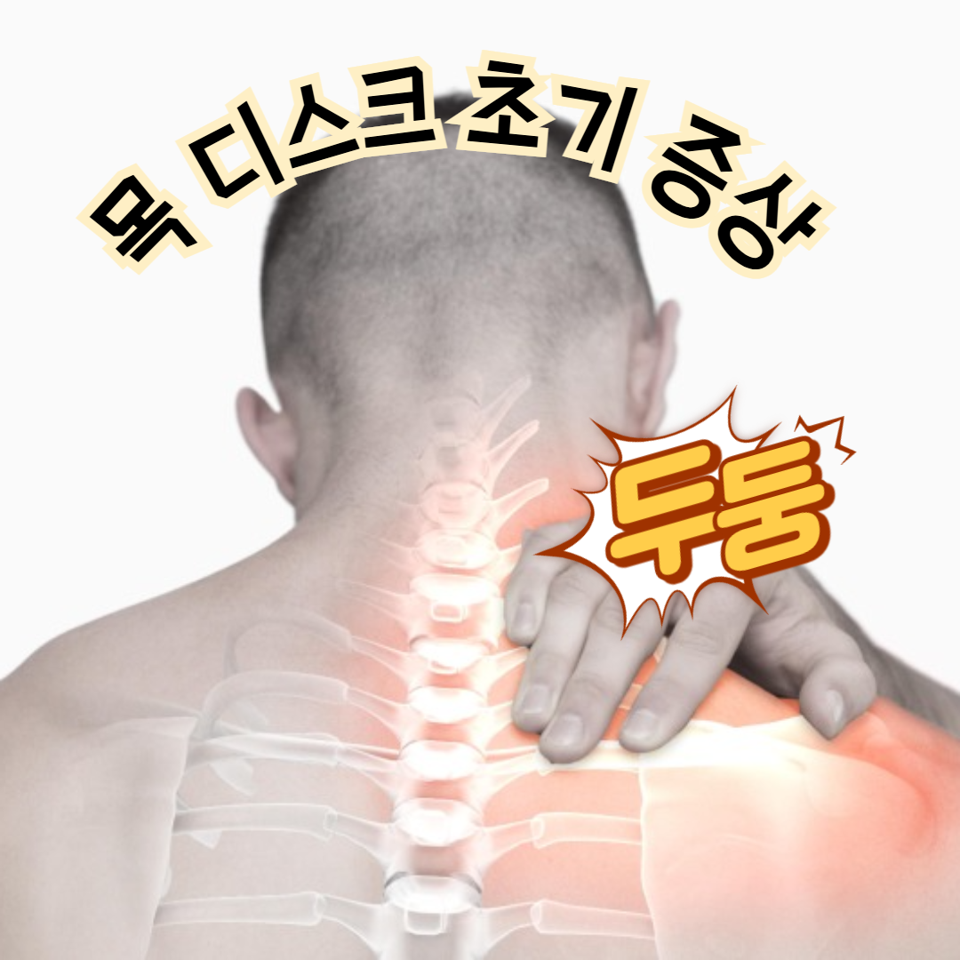 목 디스크 초기 증상, 혹시 나도?