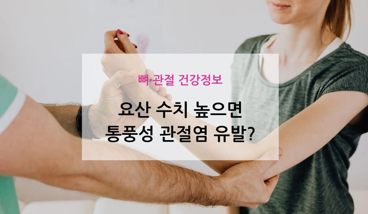 요산 수치 높으면, 통풍성 관절염