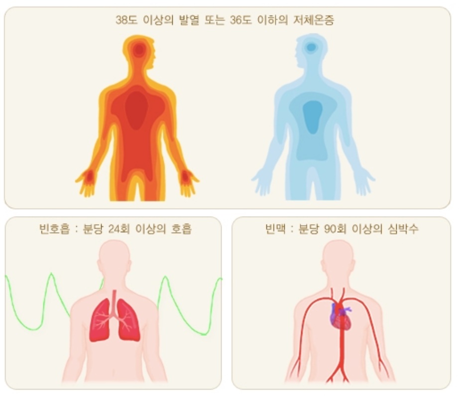  급성 패혈증 인후염 원인 치사율 알아봤습니다.
