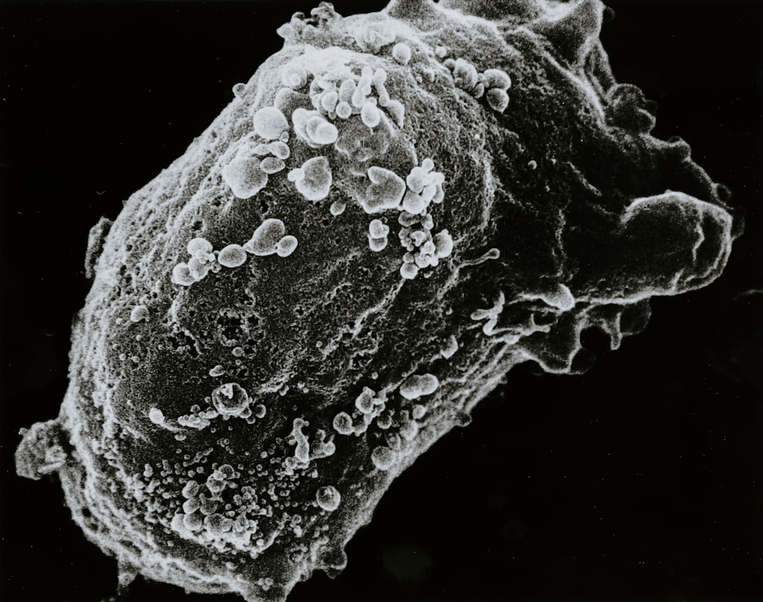 Lymphocyte