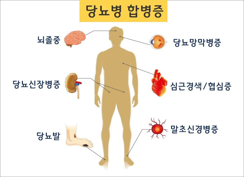 당뇨병 초기증상