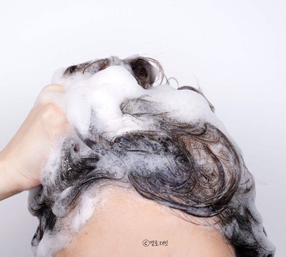 ts 탈모샴푸 이번엔 13