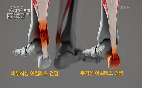 [821회] 생로병사의 비밀 - KBS821회] 생로병사의 비밀.ts_20220824_143653.483.jpg
