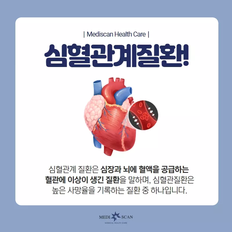 심혈관 문제