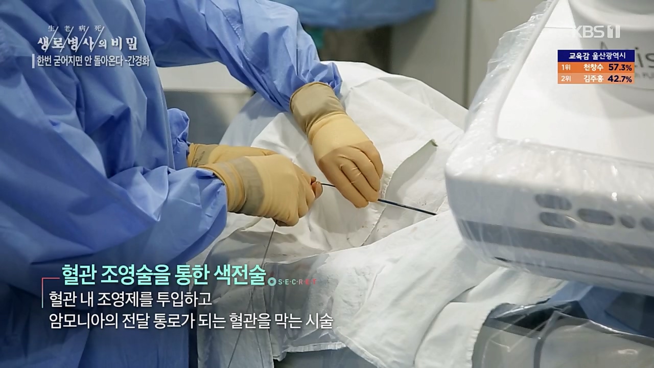 생로병사의 비밀.E863.230406p.H264-F1RST.mp4_20230406_202729.594.jpg